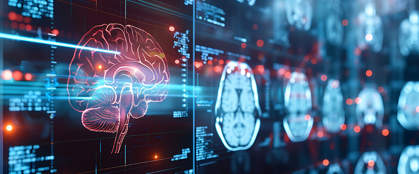 Accelerated TMS Guided by Individualized fMRI Connectivity Targeting Outperformed Conventional Targeting in Major Depression Patients
