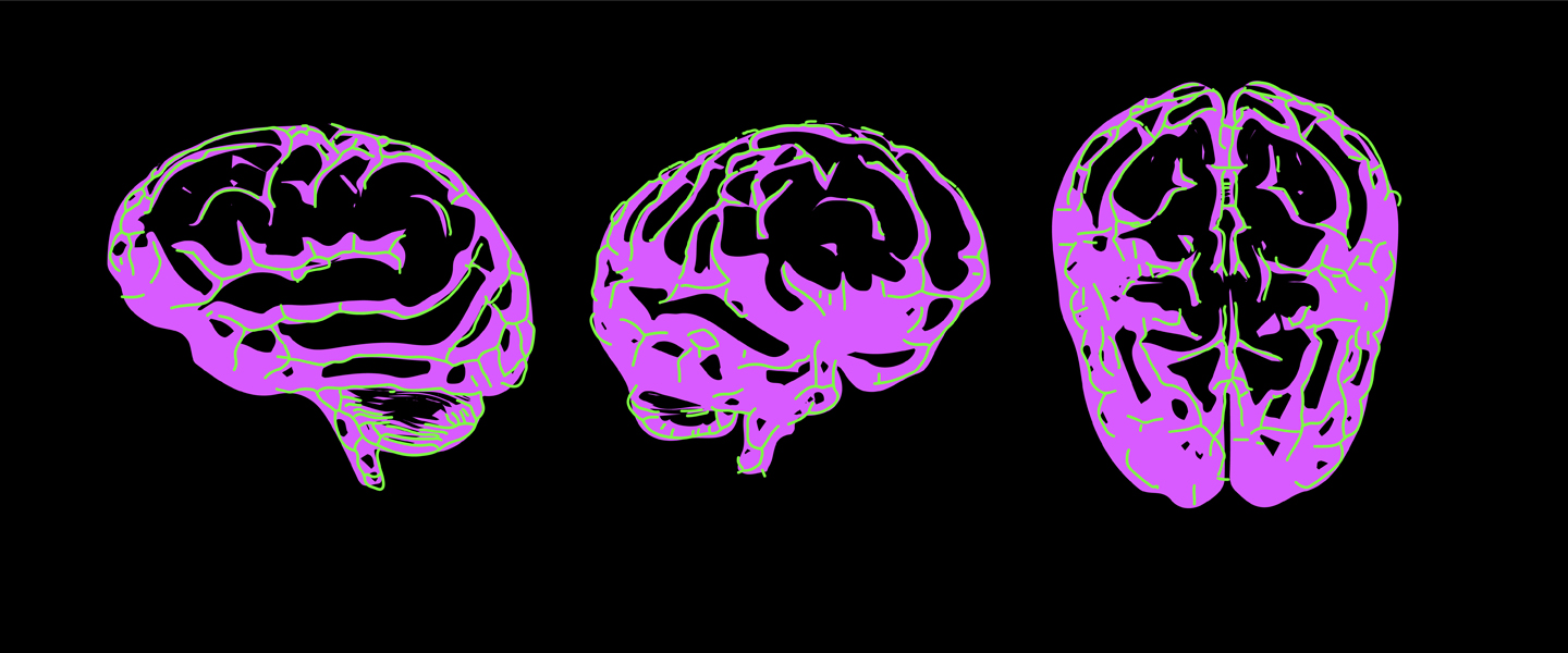 fMRI Imaging Revealed 2 Distinct Autism Subtypes Involving Under- and Over-Connectivity Patterns, with Potential Implications for Therapeutic Targeting
