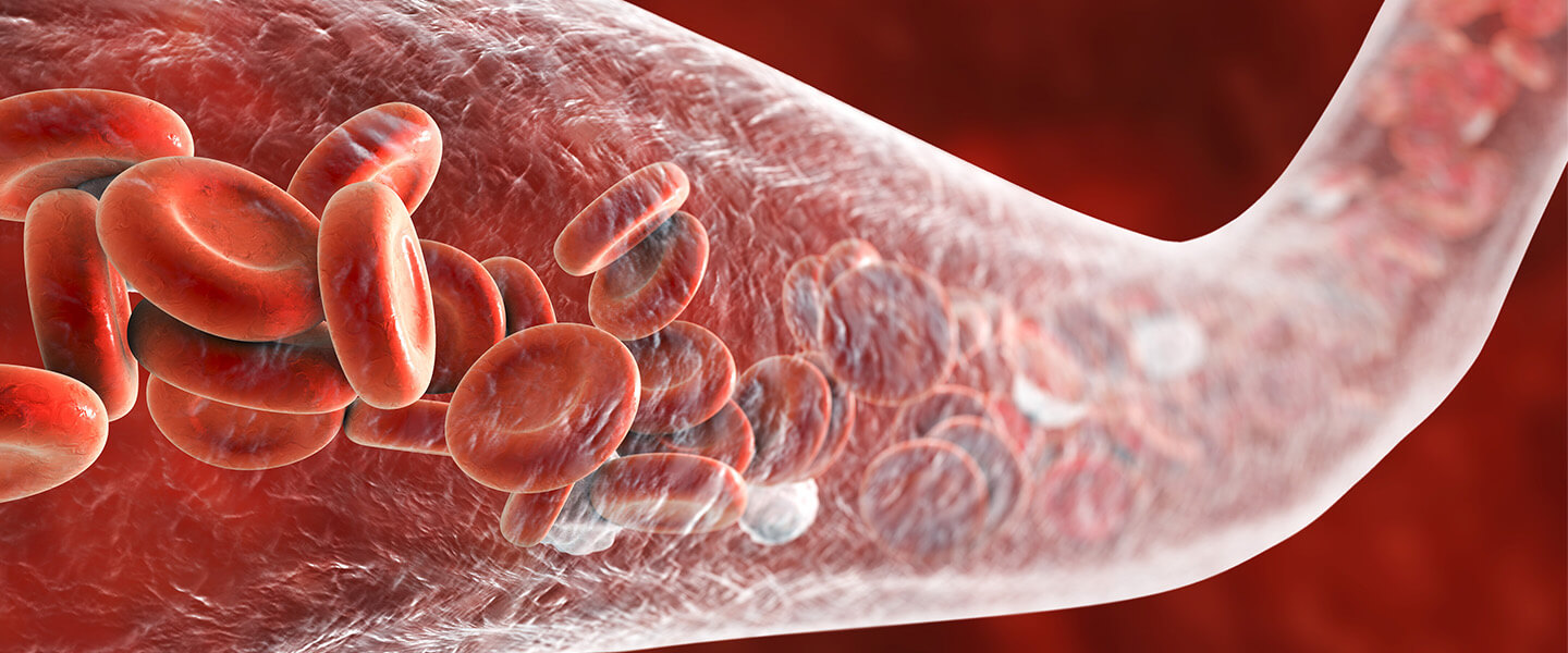 A Close Look at How COVID-19 Infection Can Damage the Brain
