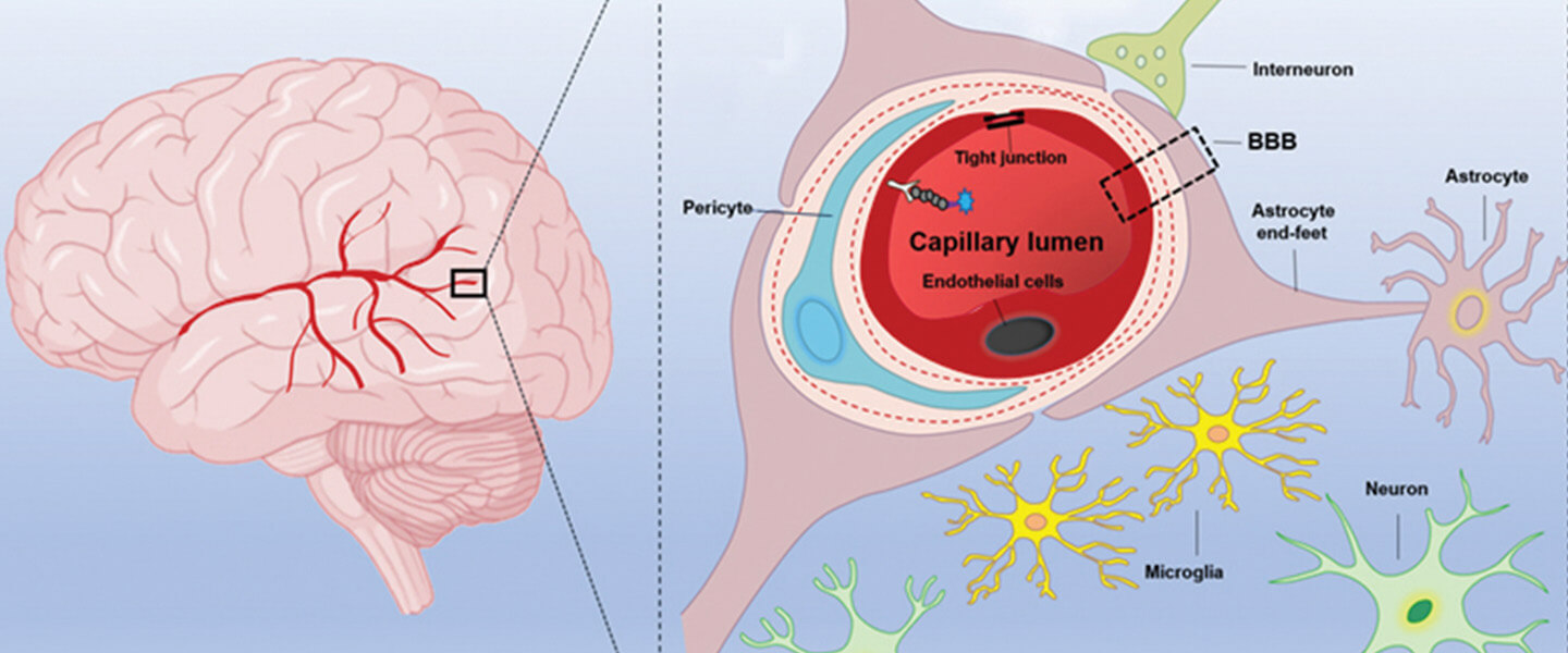 Facing permanent brain damage, patient turns to UK for unlikely