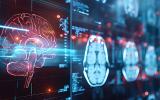 Accelerated TMS Guided by Individualized fMRI Connectivity Targeting Outperformed Conventional Targeting in Major Depression Patients