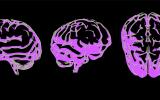 fMRI Imaging Revealed 2 Distinct Autism Subtypes Involving Under- and Over-Connectivity Patterns, with Potential Implications for Therapeutic Targeting