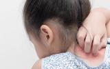 Insights Into Sensory Symptoms in Autism and Other Disorders from Stem Cell-Based Model of Key Human Sensory Pathway