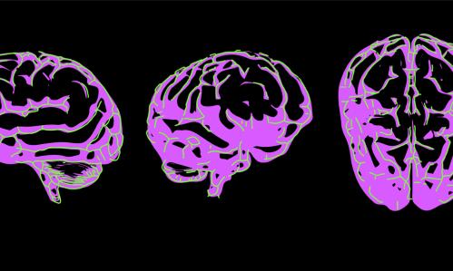 fMRI Imaging Revealed 2 Distinct Autism Subtypes Involving Under- and Over-Connectivity Patterns, with Potential Implications for Therapeutic Targeting