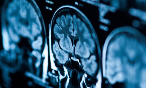 Possible Neural Signatures of Future Depression & Anxiety Onset in High-Risk Adolescents’ Resting-State Brain Scans