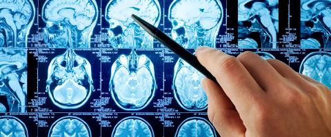 Specific Connectivity Changes and Linked Changes in White Matter Are Associated with PTSD Symptom Reduction in Clinical Trial Results Specific Connectivity Changes and Linked Changes in White Matter Are Associated with PTSD Symptom Reduction in Clinical Trial Results